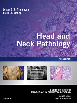 cover image of Head and Neck Pathology